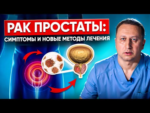 Видео: Рак предстательной железы.  Симптомы рака простаты, методы лечения и профилактика рака простаты.