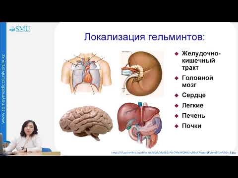 Видео: Гельминтозы