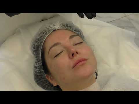 Видео: Экспресс-протокол для сухой кожи: Результат за 1 процедуру! ⚡️🍂