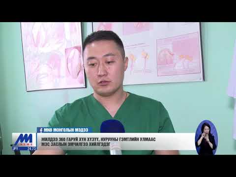 Видео: Жилдээ 360 гаруй хүн хүзүү, нурууны гэмтлийн улмаас мэс заслын эмчилгээ хийлгэдэг /2019.11.11/