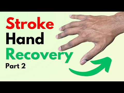 Видео: Упражнения для укрепления пальцев и кистей рук при инсульте