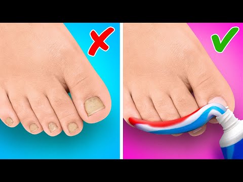 Видео: Крутые гаджеты и лайфхаки для ног || Крафты для обуви