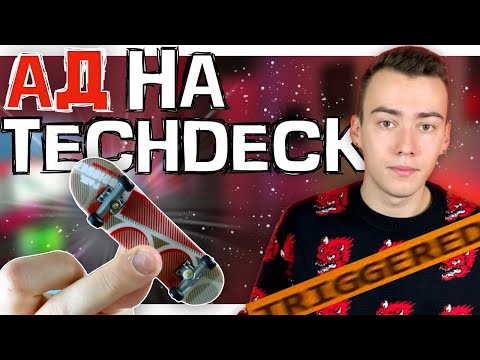 Видео: Я СГОРЕЛ НА ТЕЧДЕКЕ(ПОВТОРИ ЗА МНОЙ НА ФИНГЕРБОРДЕ)