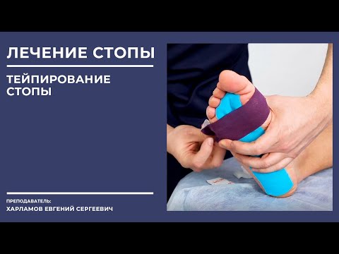 Видео: ✅Диагностика стопы. Тейпирование стопы. Изготовление стелек. Ортезирование стопы.