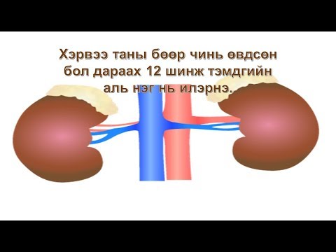 Видео: Бөөрний үрэвслийн шинж тэмдэг 😊👍💯