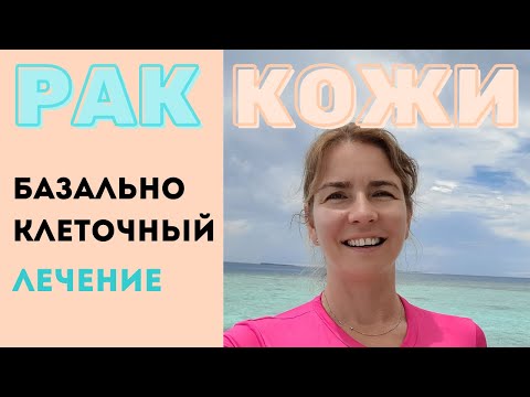 Видео: Рак кожи базальноклеточный.  Базалиома "не меланома" Факторы риска Симптомы.  Диагностика. Лечение