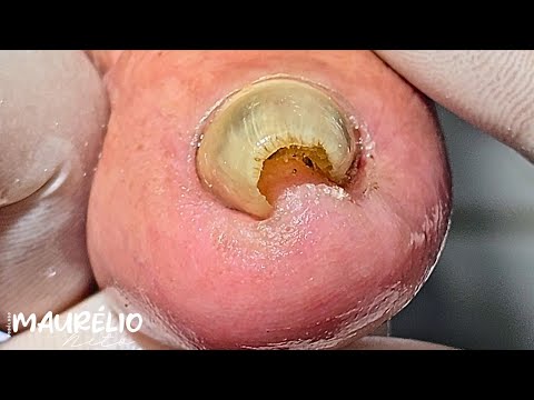 Видео: ПОСМОТРИТЕ, ЧТО ОСТАЛОСЬ!!