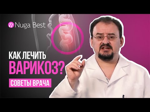Видео: Рекомендации врача | Варикоз и как его лечить?
