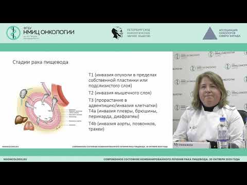 Видео: Лучевая диагностика рака пищевода (Мутовкина Н.И.)