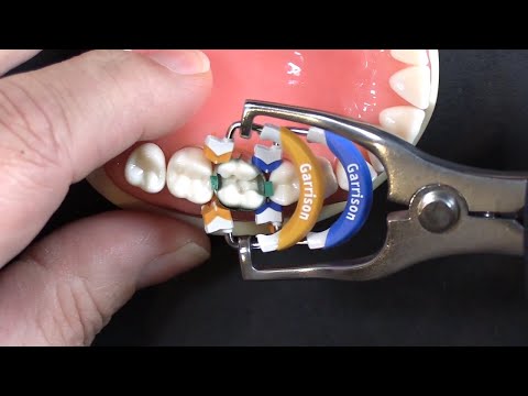 Видео: 5 самых популярных вопросов: #4 | Восстановление MOD