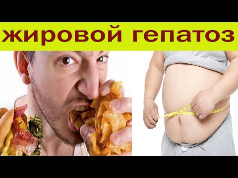Видео: Как навсегда вылечить жировой гепатоз. Универсальное лекарство..
