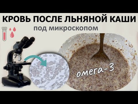 Видео: Кровь течет, как быстрая река!  ...после льняной каши