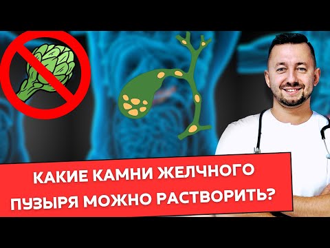 Видео: Растворение камней в желчном пузыре