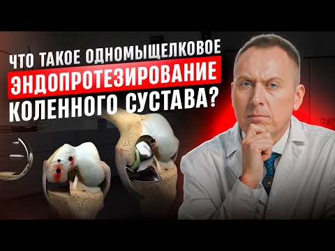 Видео: Современные методы лечения артроза колена которые работают.