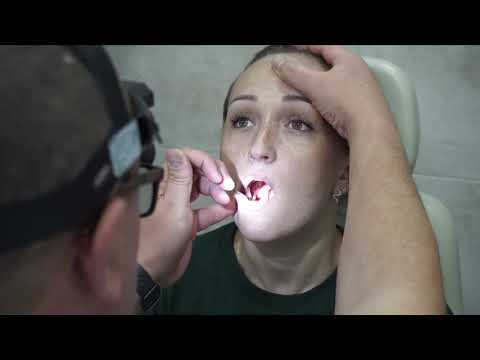 Видео: Практические навыки. ОНМедУ. Кафедра Оториноларингологии.