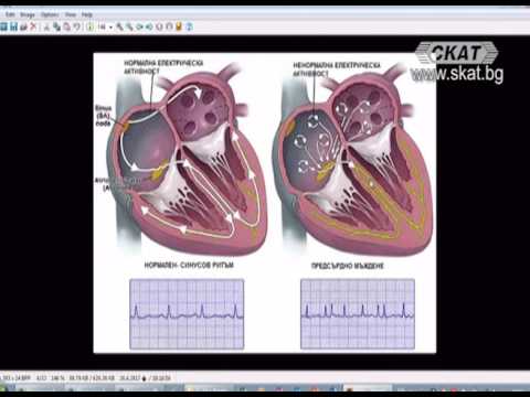 Видео: Академия ЗдравОсловно: Възбудно-проводна система на сърцето