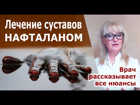Видео: Лечение суставов нафталаном.  Как лечат суставы в Нафталане.