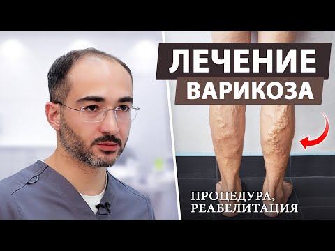 Видео: Варикоз на ногах: симптомы и эффективное лечение