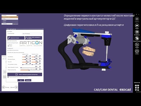 Видео: Виртуальный Артикулятор: Определение первого контакта в ЦС - цифровой протокол