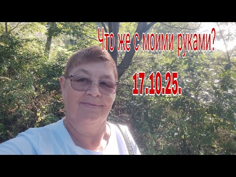 Видео: 17.10.25.Что же было с моими руками. / Была опять у врача. 