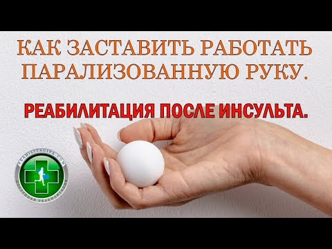 Видео: Как включить в работу парализованную руку. Контроль спастики. Реабилитация после инсульта.