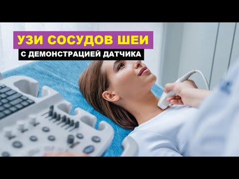 Видео: УЗИ сосудов ШЕИ. Порядок выполнения. Демонстрация установки ДАТЧИКА.