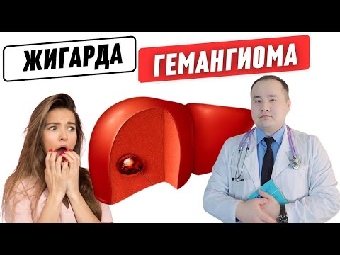 Видео: ЖИГАР ГЕМАНГИОМАСИ, САБАБЛАРИ, БЕЛГИЛАРИ, АСОРАТЛАРИ ВА ДАВО ЧОРАЛАРИ ХАҚИДА МАЪЛУМОТ ДОКТОР ИСЧАНОВ