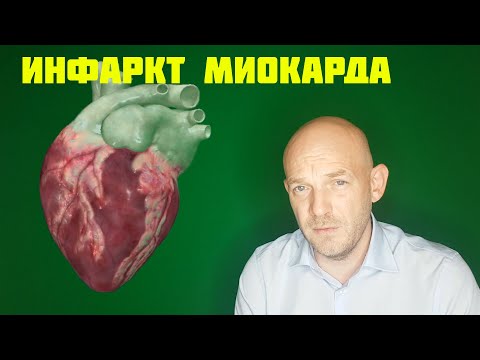 Видео: ИНФАРКТ МИОКАРДА