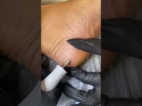 Видео: Баскова Марафон 02 Как упростить и ускорить обработку пальцев 02часть