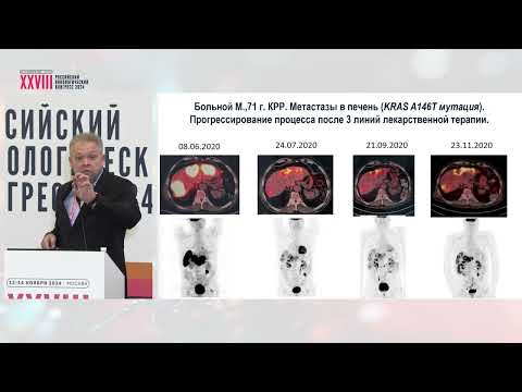 Видео: Метаболические особенности злокачественных опухолей: есть ли место в клинической практике?