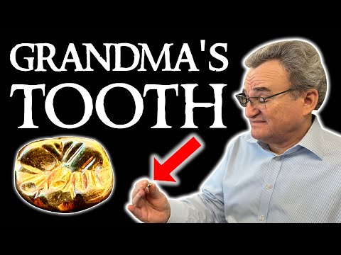 Видео: Сколько стоит золотой зуб моей бабушки? Оценка золота