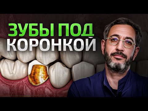Видео: Болит ЗУБ под КОРОНКОЙ — что делать? Отвечает врач высшей категории