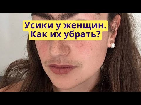 Видео: Растительность на лице у женщин. Усики у женщин.