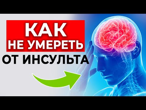 Видео: 🫀Защитись от ИНСУЛЬТА одним действием! | Профилактика инсульта