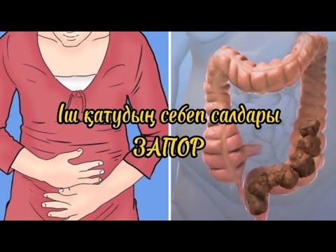 Видео: Іш қатудың себеп салдары. ЗАПОР