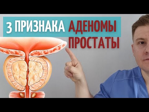 Видео: АДЕНОМА ПРОСТАТЫ. Проверь эти ПРИЗНАКИ у себя.