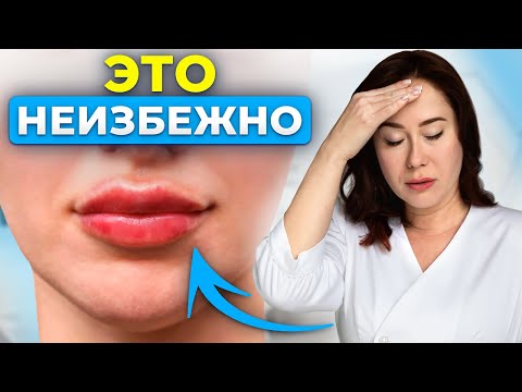 Видео: Косметологи это не расскажут о ФИЛЛЕРАХ! Неудобная правда.…