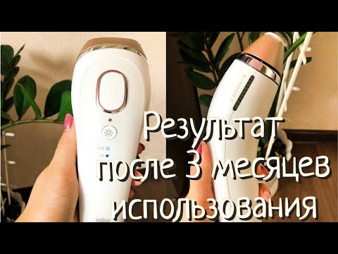 Видео: Фотоэпилятор Braun | Удаление волос | РЕЗУЛЬТАТ | Стоит ли покупать?