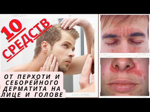Видео: 🙆‍♀️10 средств от ПЕРХОТИ и СЕБОРЕЙНОГО ДЕРМАТИТА Лице Голове, и Теле. Примеры средств и Фото.