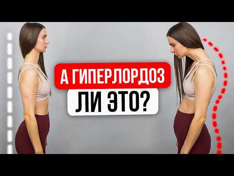 Видео: Убираем излишний прогиб в спине и выпуклый живот. Гиперлордоз, что это такое?