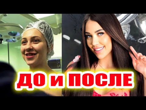 Видео: Участницы Дома-2 До и После пластики