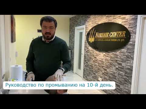 Видео: 🔷🔶   ДЕСЯТЫЙ ДЕНЬ ПОСЛЕ ПЕРЕСАДКИ ВОЛОС 🔷🔶