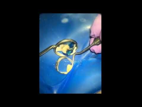 Видео: 2020-12-11 Глубокое расхождение каналов