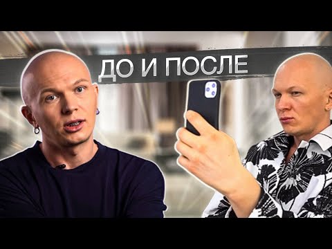 Видео: Пластическая хирургия | реалити-шоу Мама, я стилист | 3 Выпуск | Сезон 2 |
