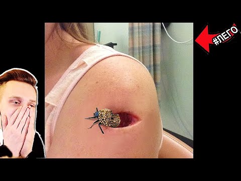 Видео: Попробуй не скажи ОЙ! / РЕАКЦИЯ на САМОЕ НЕ ПРИЯТНОЕ ВИДЕО в МИРЕ