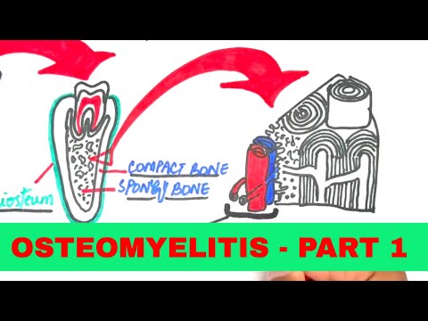 Видео: Остеомиелит — причины, патофизиология, клинические проявления и лечение | часть 1