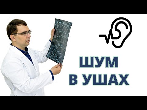 Видео: ШУМ В УШАХ: почему шумит и что с этим делать?