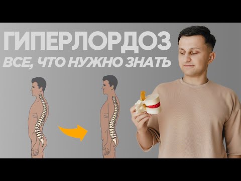 Видео: Настоящая причина ГИПЕРЛОРДОЗА. Как исправить гиперлордоз в спине, современные данные