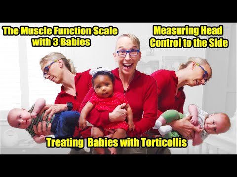 Видео: # 24 Измерение контроля головы в сторону - шкала мышечной функции у 3 детей: лечение кривошеи