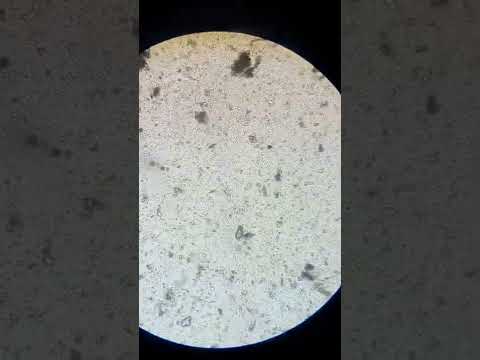 Видео: Смотрим на простейших в микроскоп. Научимся готовить препарат из мха.